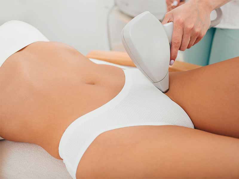 Newer, better & more comfortable – Super Hair Removal SHR vs IPL Hair Removal- Why SHR Is Better