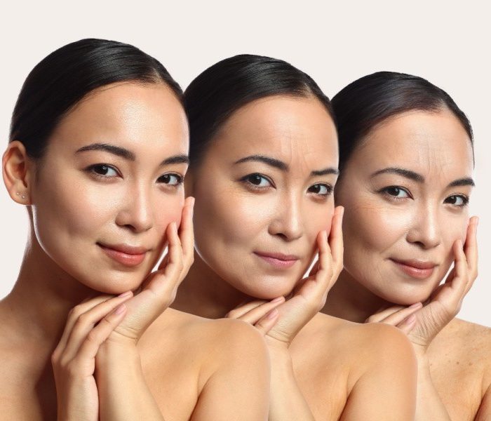 Misconception Collagen Treatment1