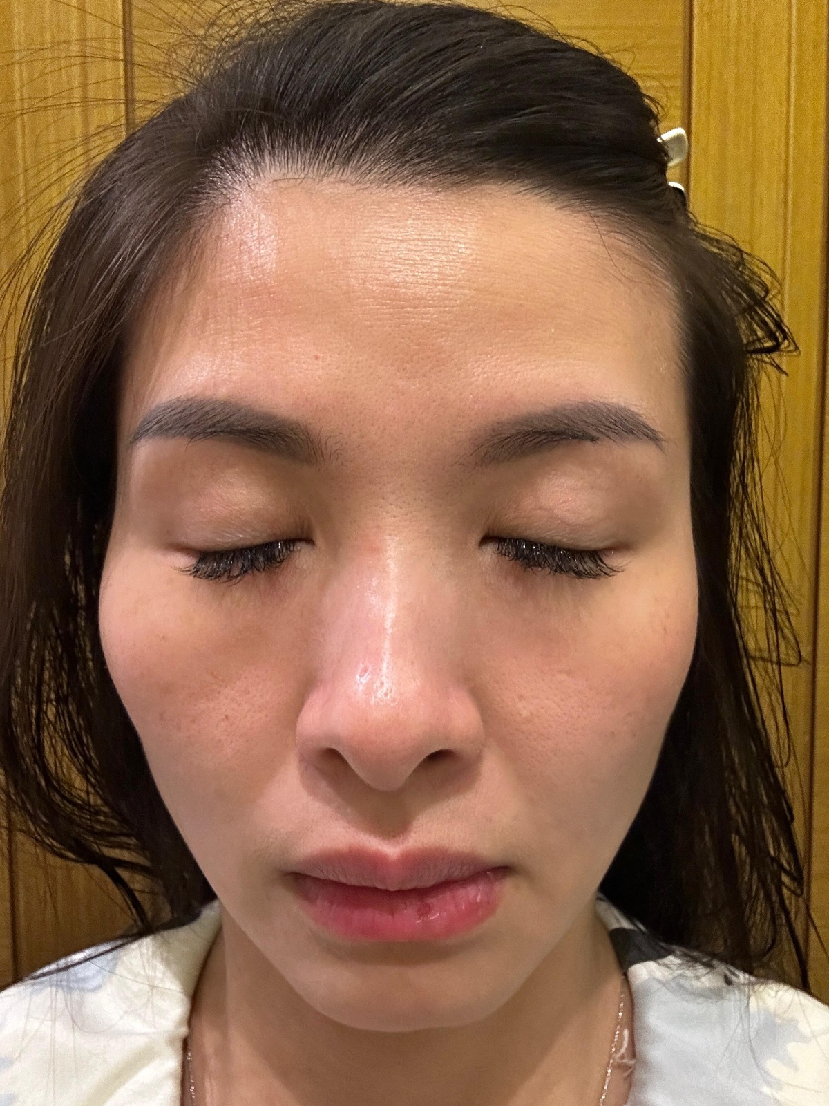 Client Results Before